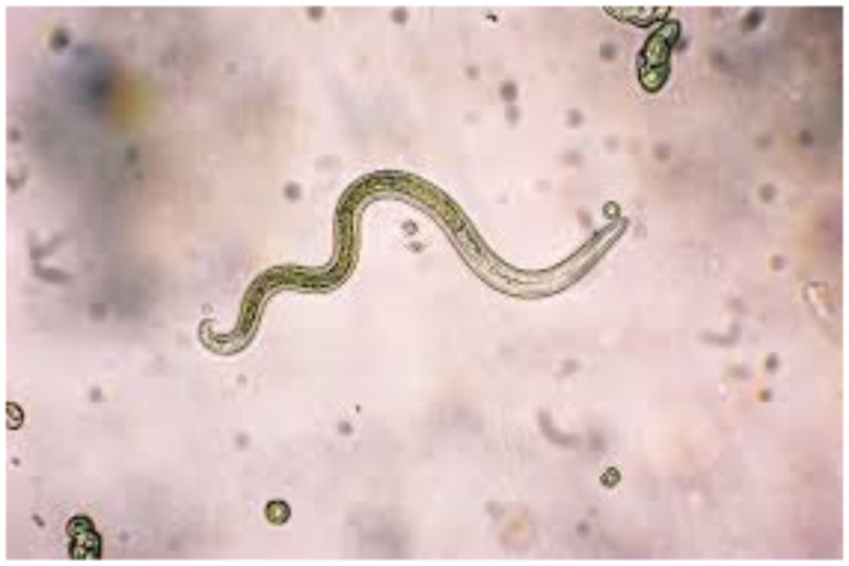 What Is There To Know About A Parasite Cleanse? What Is There To Know About A Parasite Cleanse?