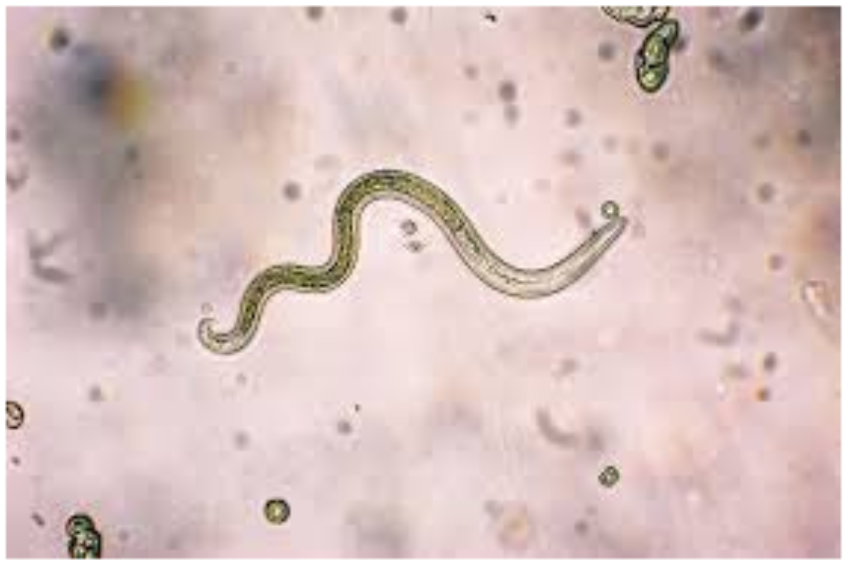 Know About A Parasite Cleanse?